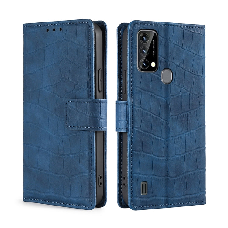 For Blackview A50 Skin Feel Crocodile Magnetic Clasp Leather Phone Case(Blue) - More Brand by buy2fix | Online Shopping UK | buy2fix