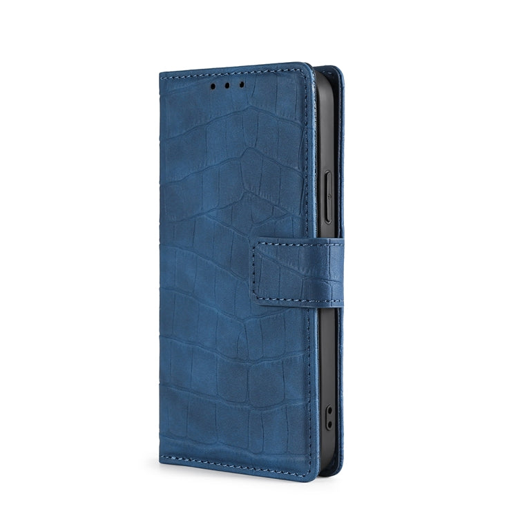 For Blackview A50 Skin Feel Crocodile Magnetic Clasp Leather Phone Case(Blue) - More Brand by buy2fix | Online Shopping UK | buy2fix